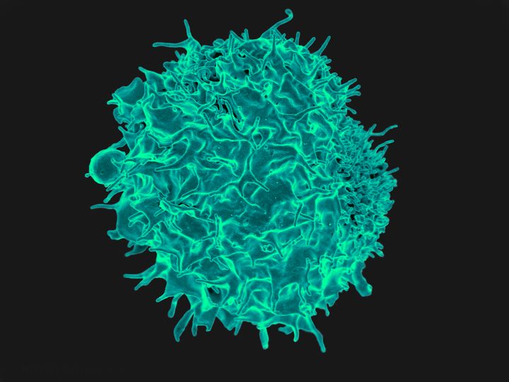 Cancer Targeting CAR T-Cells: Can They Treat Autoimmune Diseases?