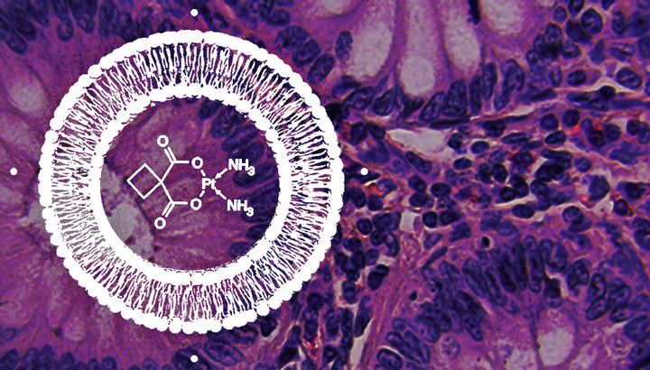 Novel Image-guided Nanoparticles Poised for Cancer Clinical Trials